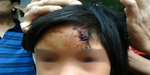 Bé gái bị bạo hành trong chùa: Sư thành tâm sám hối