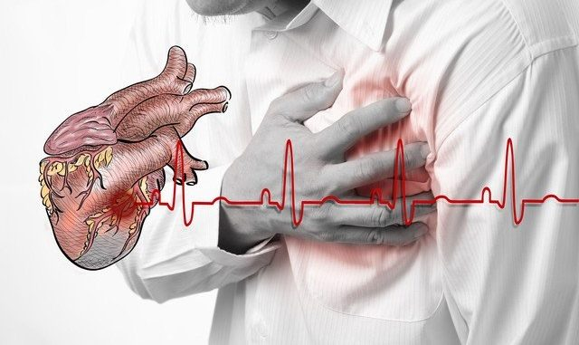 Nguyên nhân làm tăng nguy cơ bệnh tim mạch
