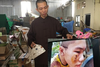 Nhuộm Máu bồng Lai